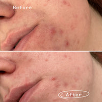 Phaze™ Gel Cleanser Mini