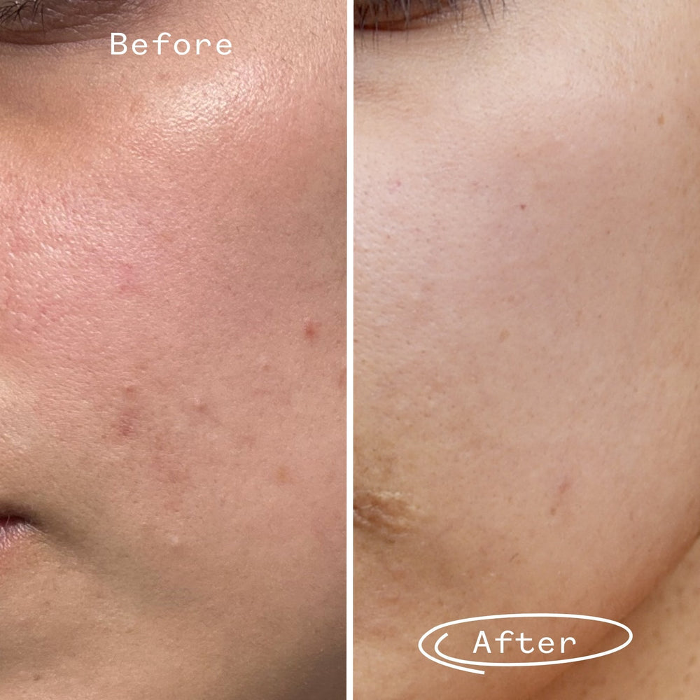 Tri-Mushroom 10% Super-Soothing Booster