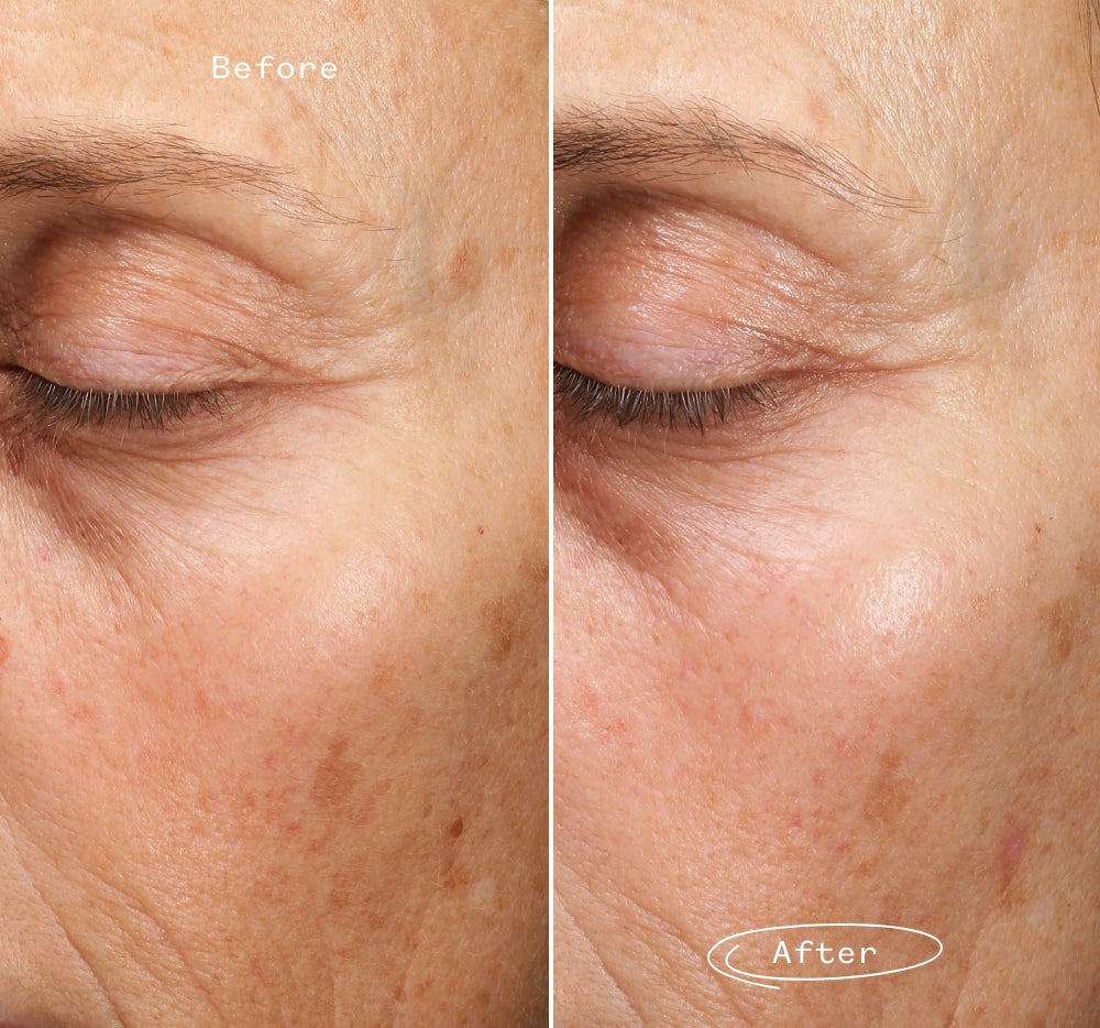 Fade Forward™ Serum